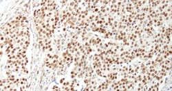 NUCKS1 Antibody, Novus Biologicals 0.1mg; Unlabeled:Antibodies, Polyclonal